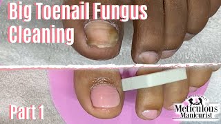 How To Pedicure Toenail Fungus Home Remedy Cleaning Part 1 [upl. by Claudell]