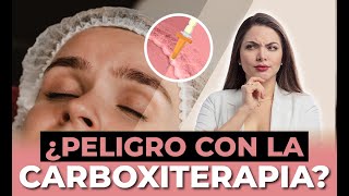 DESCUBRE TODOS LOS BENEFICIOS DE LA CARBOXITERAPIA EN TU CUERPO [upl. by Boleyn]