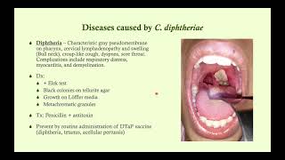 Corynebacterium diphtheriae Diphtheria  Microbiology Boot Camp [upl. by Ayarahs]