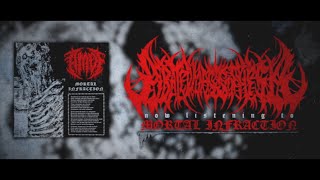 ABATED MASS OF FLESH  MORTAL INFRACTION SINGLE 2024 SW EXCLUSIVE [upl. by Biebel]