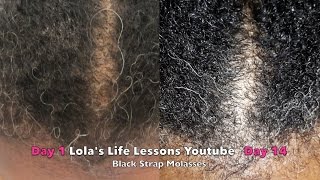 BLACKSTRAP MOLASSES NATURAL REMEDY FOR GRAY NATURAL HAIR ☕ [upl. by Neerhtak676]