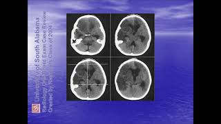 ultrasound radiologysonology [upl. by Enuahs643]