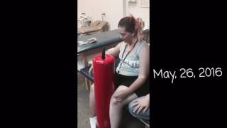 C3 C4 C5 Spinal Cord Injury Sitting Balance [upl. by Anavlis]