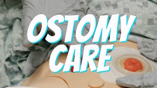 Colostomy and Ileostomy Care and Bag Change  Nurse Skill Demo [upl. by Nospmoht37]