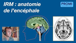 IRM  anatomie de lencéphale [upl. by Emlynne]