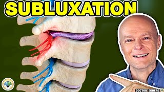 Chiropractic Subluxation [upl. by Harberd916]