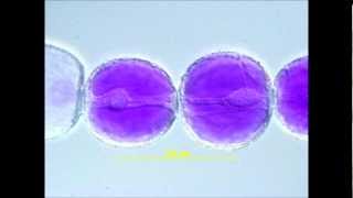 Cytoplasmic Streaming in Tradescantia Stamen Hair Cells [upl. by Lovato]