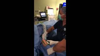 TENEX surgery for Golfers Elbow Epicondylitis by Dr Alejandro Badia [upl. by Belayneh]