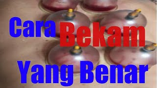 Tata Cara Bekam Yang Benar [upl. by Wester136]