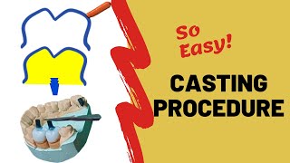 PROSTHODONTICS  Casting procedure in dentistry [upl. by Fortunia]