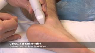 Echomsinfo  Gaine des tendons fibulaires [upl. by Daphna]