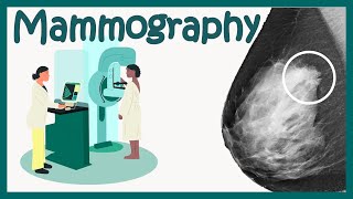 Mammography Test  Mammogram for breast cancer  What to expect  How to identify breast cancer [upl. by Saixela]