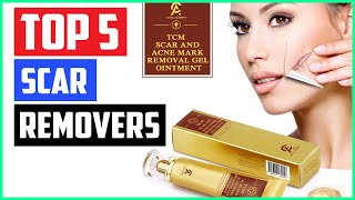 Top 5 Best Scar Removers Products Review In 2020 [upl. by Valley]