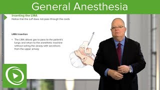 General Anesthesia – Anesthesiology  Lecturio [upl. by Dnomhcir]