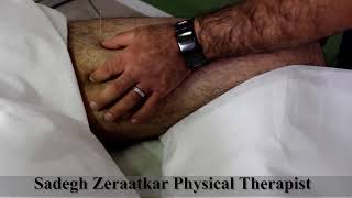 treatment of groin pain with dry needling [upl. by Erkan367]