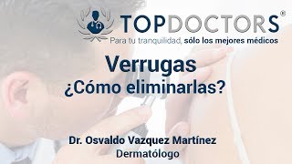 ¿Cómo eliminar las verrugas  Tratamientos [upl. by Lamrej446]