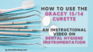 How to use the Gracey 1314 Curette [upl. by Chenay]