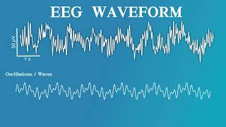 Broad overview of EEG data analysis analysis [upl. by Ronen766]