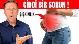 ŞİŞKİNLİK Nedir Dr Berg Türkçe [upl. by Areem]