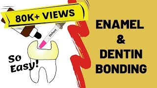 Enamel and Dentin Bonding Simplified [upl. by Benilda751]