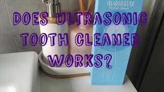 Ultrasonic Tooth Cleaner  Does It Work Honest Review [upl. by Fi755]