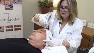 Dermaroller® Microneedling  eDermaStamp Training Video [upl. by Pascasia891]