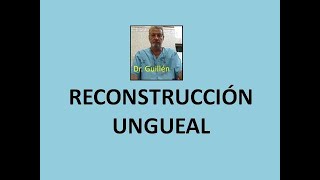 Reconstrucción ungueal [upl. by Edmund]