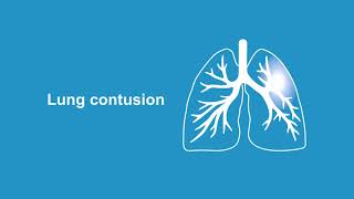 Finding lung pathologies using ultrasound [upl. by Vieva508]