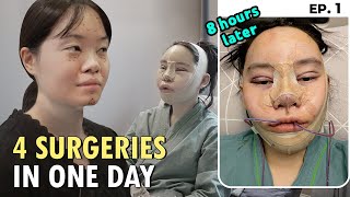 SUB quotI GOT A FULL FACE PLASTIC SURGERY IN KOREAquot VLOG  FACIAL CONTOURING RHINOPLASTY amp RECOVERY [upl. by Filomena]