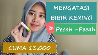 Mengatasi Bibir Kering dan PecahPecah  Review Viva Lip Balm Chic on Lips Untuk Remaja [upl. by Erroll]