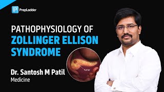 Pathophysiology of Zollinger Ellison Syndrome by Dr Santosh M Patil [upl. by Eyoj]