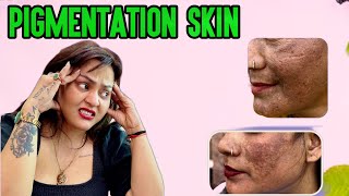 How To Treat Pigmentation At Home Skin Care Routine In Hindi  Pigmentation Skin 2024 Nisha Lambha [upl. by Minda638]