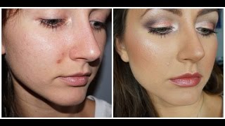 How To Cover Acne amp Scars amp Blemishes  Monday Makeup Lesson [upl. by Ellehciram]