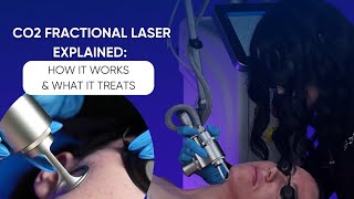 CO2 Fractional Laser Explained How It Works amp What It Treats [upl. by Lowenstern]