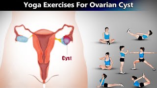 7 Yoga Poses for Ovarian Cyst [upl. by Renny757]