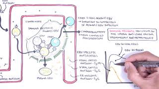 Epstein Barr Virus and Infectious Mononucleosis pathophysiology investigations and treatment [upl. by O'Rourke815]