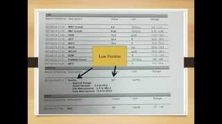 Microcytic anemia  Hematologic System Diseases  NCLEXRN  Khan Academy [upl. by Rutter]