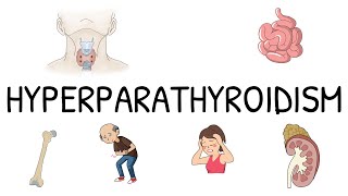 Hyperparathyroidism Primary Secondary and Tertiary  Simple and easy to understand [upl. by Inneg]