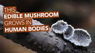 This Edible Mushroom Grows In Human Bodies [upl. by Reteid]