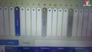 Liason diasorin machineHow to use machineall details for new operatorsScreen specifications [upl. by Rehtaeh]