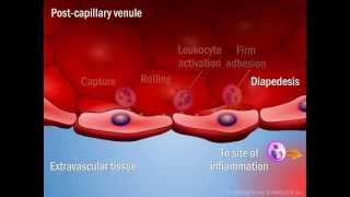 Crohn  Rectocoliteulcérohémorragique  Docteur Synapse [upl. by Christianna621]