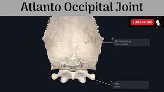 Cervical Spine Trauma on CT [upl. by Nnaytsirk]