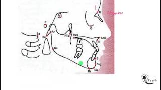 Cephalometrics Part 1 [upl. by Samala]