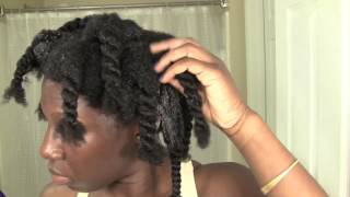 SCALP INFECTION A Doctor Explains How You Get Scalp Fungus and How to Treat It [upl. by Jat]