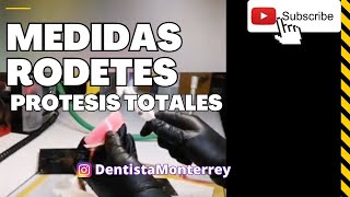 🤔CUÁNTO MIDEN ❓Los RODETES de CERA 👅 Prótesis TOTALES [upl. by Adnael]