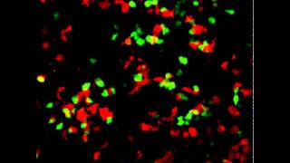 Twophoton microscopy of Bone marrow derived DCT cell interaction [upl. by Abby651]