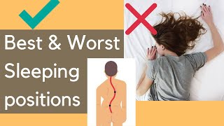 Best sleeping positions for scoliosis [upl. by Treb]