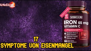 17 Symptome von Eisenmangel [upl. by Airrej]