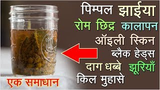 त्वचा से जुड़ी सारी समस्याओं का एक मात्र सबसे असरदार घरेलु उपाय Best drink for Skin amp Immune System [upl. by Benjie]