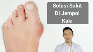 Solusi Sakit Di Jempol Kaki [upl. by Anitsirc]